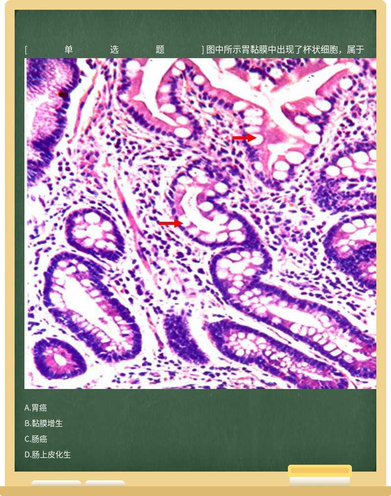 图中所示胃黏膜中出现了杯状细胞，属于 