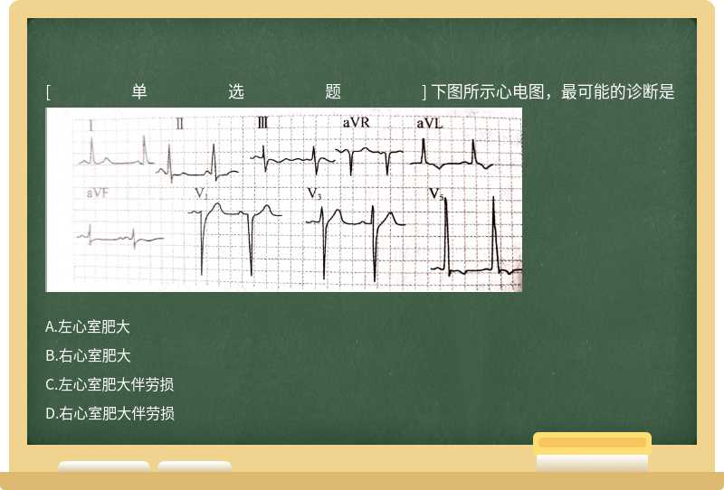 下图所示心电图，最可能的诊断是 