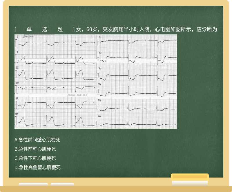 女，60岁，突发胸痛半小时入院，心电图如图所示，应诊断为