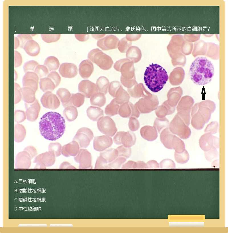 该图为血涂片，瑞氏染色，图中箭头所示的白细胞是？ 