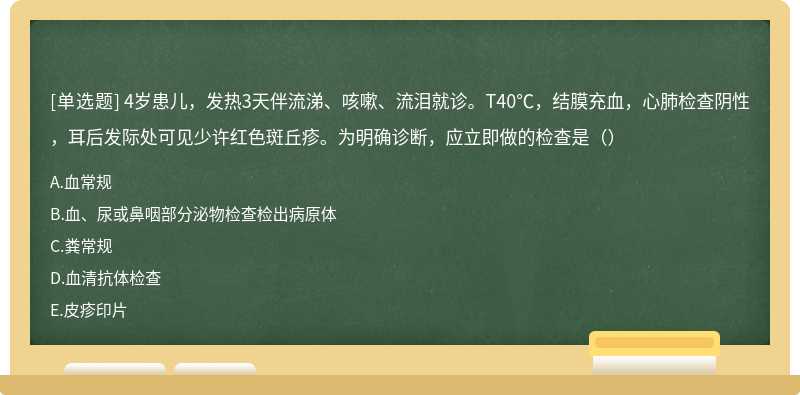 4岁患儿，发热3天伴流涕、咳嗽、流泪就诊。T40℃，结膜充血，心肺检查阴性，耳后发际处可见少许红色斑丘疹。为明确诊断，应立即做的检查是（）