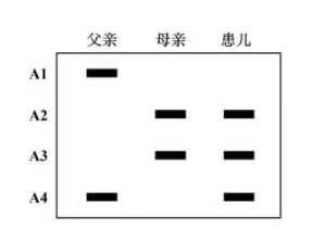 为了分析某21三体综合征患儿的病因，对该患儿及其父母的21号染色体上的A基因（A1～A4）进行PCR